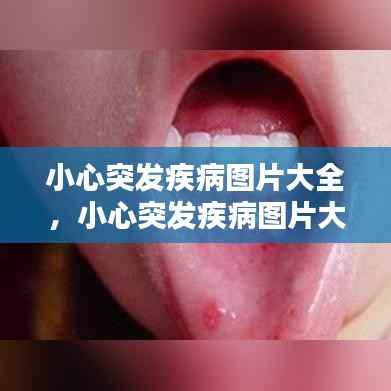 小心突发疾病图片大全,小心突发疾病图片大全大图