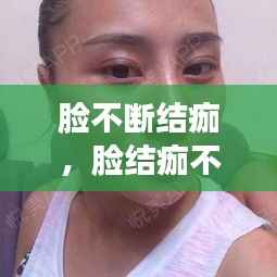 脸不断结痂,脸结痂不掉怎么办