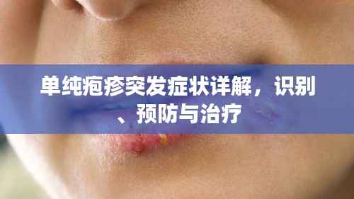 单纯疱疹突发症状详解,识别、预防与治疗