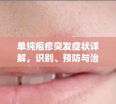 单纯疱疹突发症状详解,识别、预防与治疗